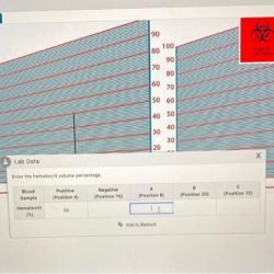 Blood hematocrit lab measure laboratory simulation