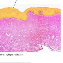 Highlighted identify epithelial solved epithelium transcribed