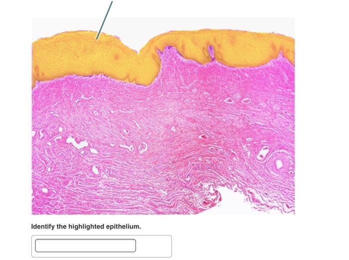 Highlighted identify epithelial solved epithelium transcribed