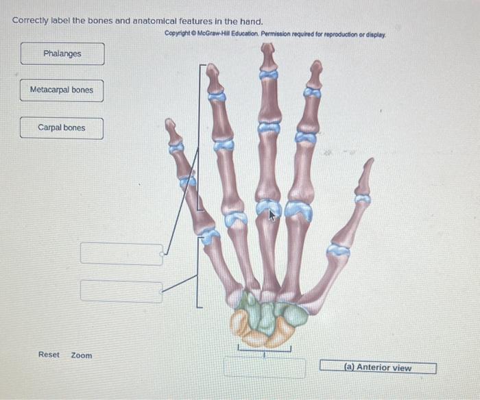 Correctly label the bones and anatomical features in the hand