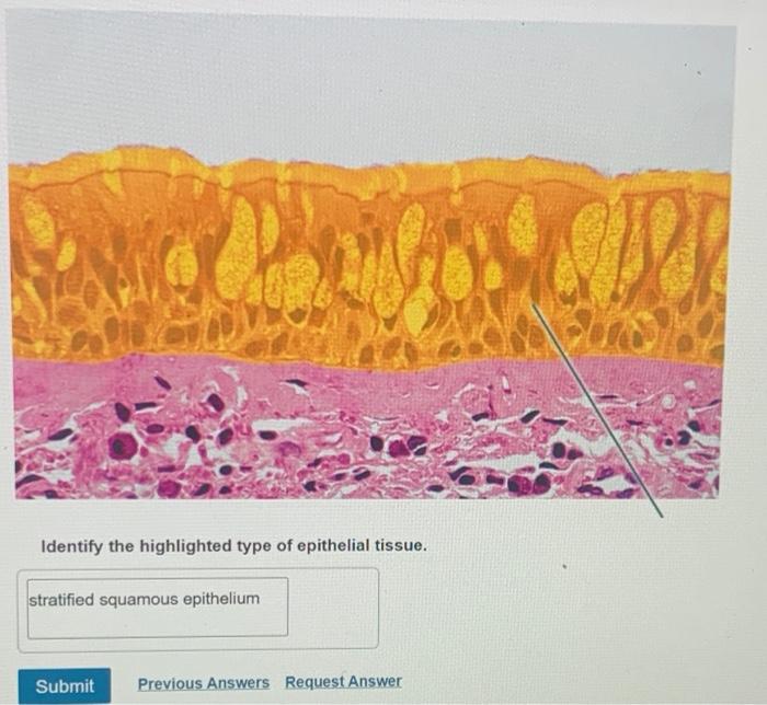 Identify the highlighted type of epithelial tissue