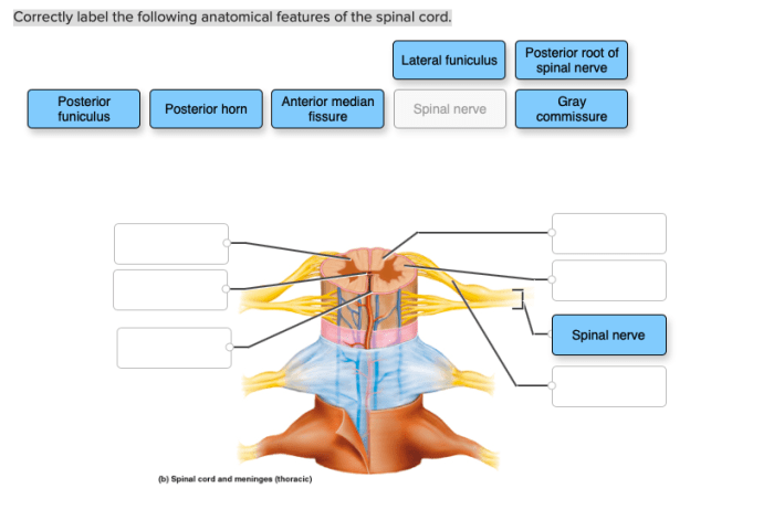 Correctly label the bones and anatomical features in the hand