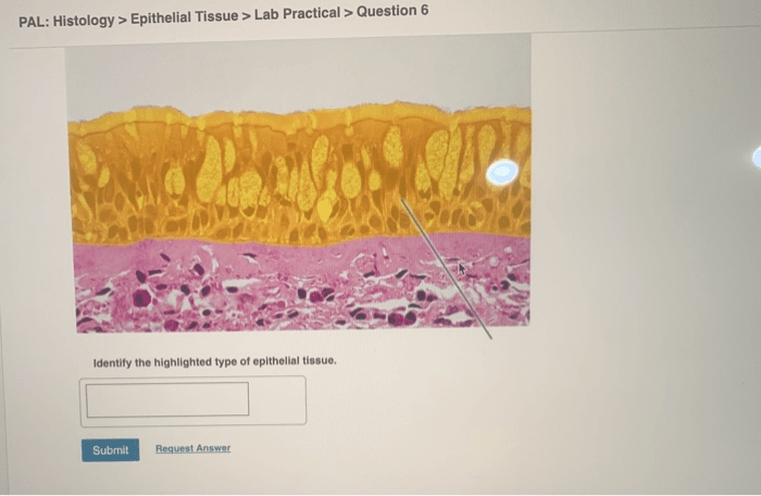 Epithelium types covering animal histology squamous epithelial cell type tissues 3d des figure anatomie atlas plant physiologie und gemerkt von