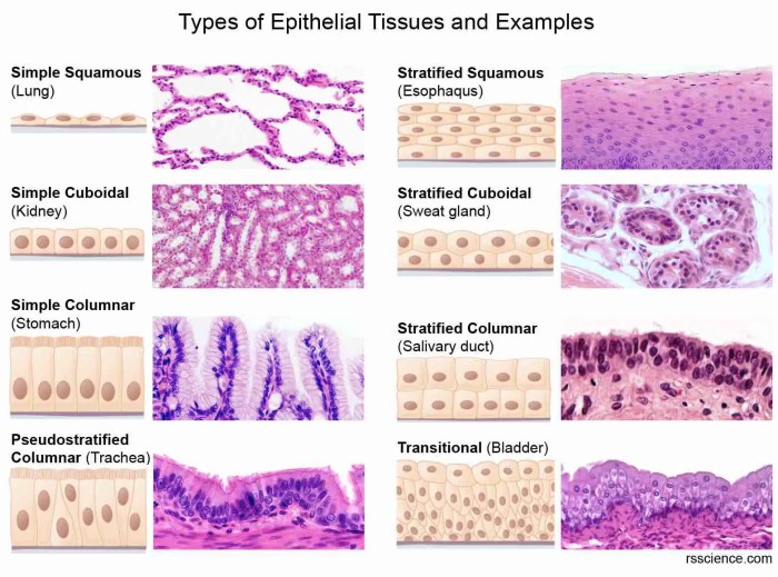 Identify the highlighted type of epithelial tissue